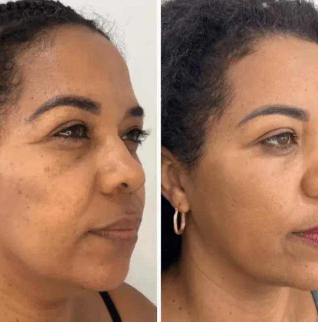 Mascarilla de Colágeno Coreana Rejuvenecedora