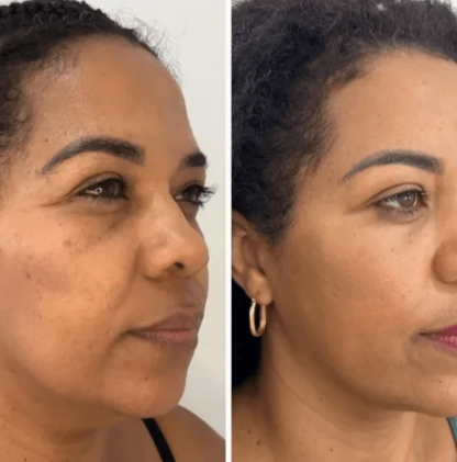 Mascarilla de Colágeno Coreana Rejuvenecedora