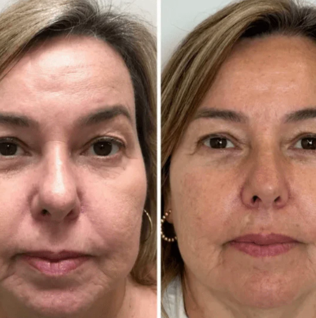 Mascarilla de Colágeno Coreana Rejuvenecedora