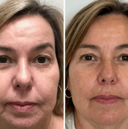 Mascarilla de Colágeno Coreana Rejuvenecedora