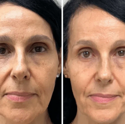 Mascarilla de Colágeno Coreana Rejuvenecedora
