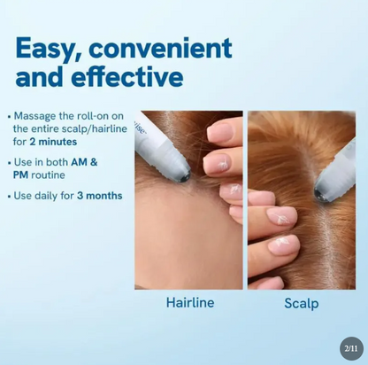 Fluido Roll-On para el Crecimiento del Cabello