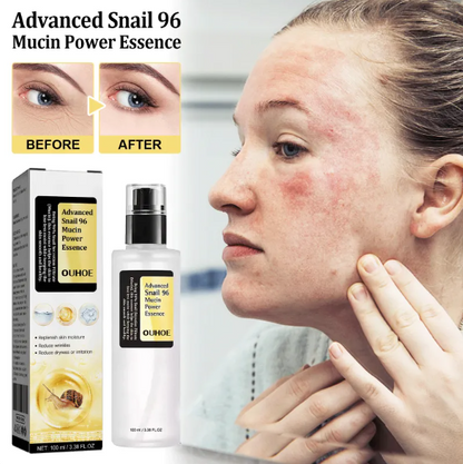 Suero Facial de Colágeno de Caracol Original
