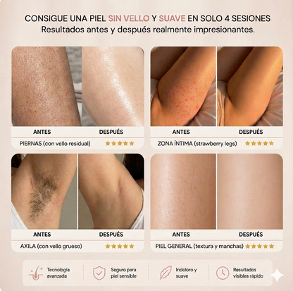 Depilación fácil e indolora